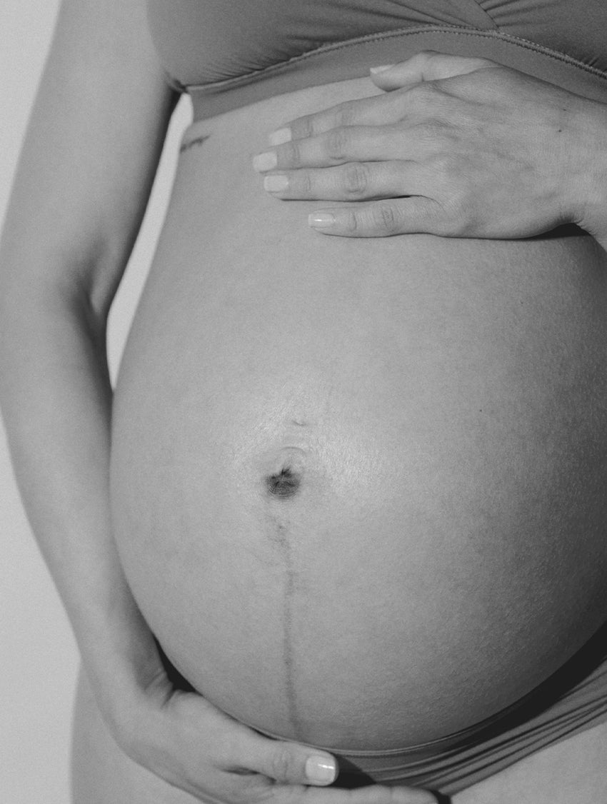 How I Treat My Melasma While Pregnant