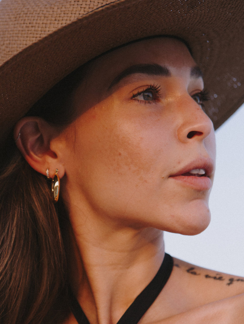 Demystifying Melasma